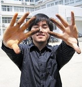 于佳