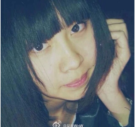 张蕊