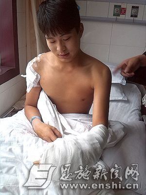17岁小伙倒洗脚水泼到孕妇被连砍数刀