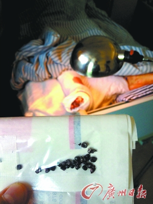 夫妻打牌被疑"出老千"身中百余颗钢珠子弹